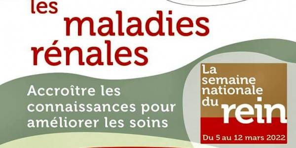 small_articles_49099